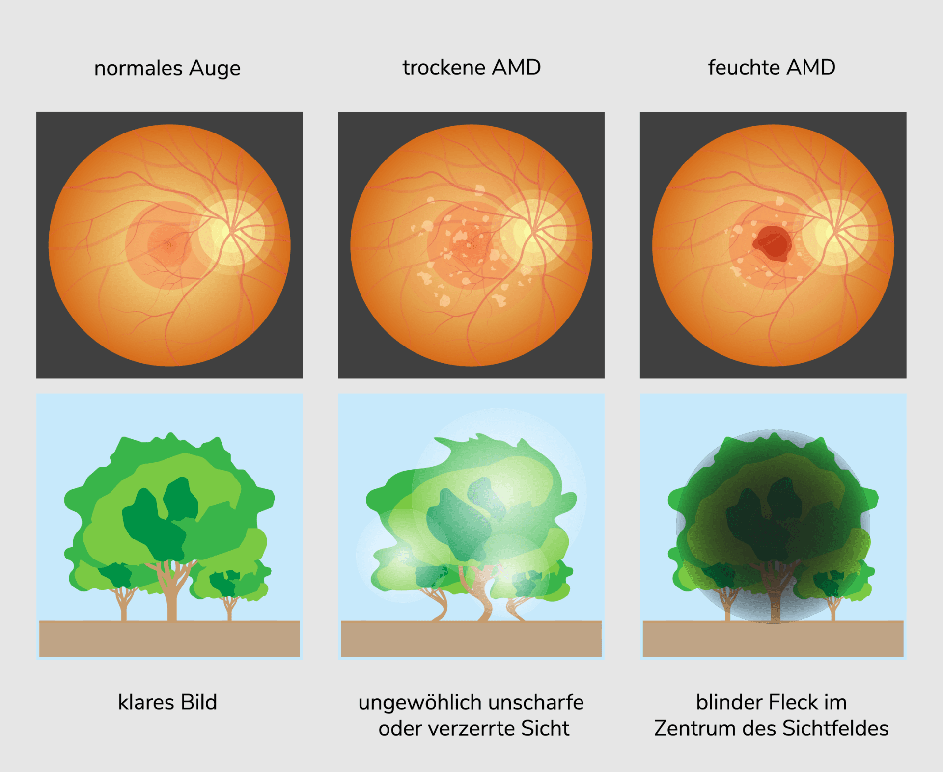 Simulation der sichteinschränkenden Symptome bei AMD