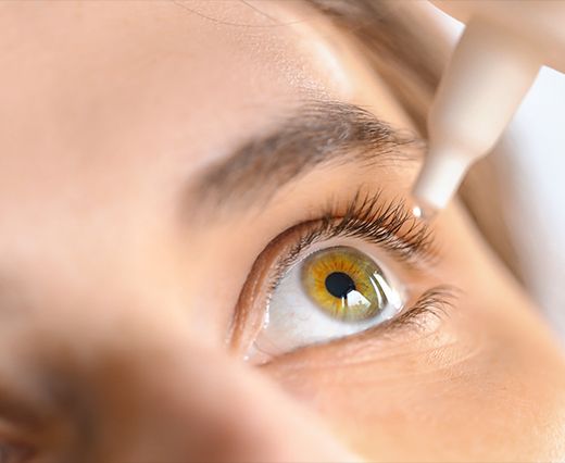 Eine gute Abhilfe bei Augentrockenheit können spezielle Augentropfen schaffen. Sprechen Sie unbedingt mit Ihrem Augenarzt, welche Lösung für Sie in Frage kommt.